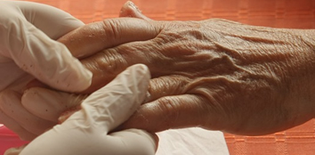 Independência de paciente com Alzheimer pode ser prolongado com fisioterapia